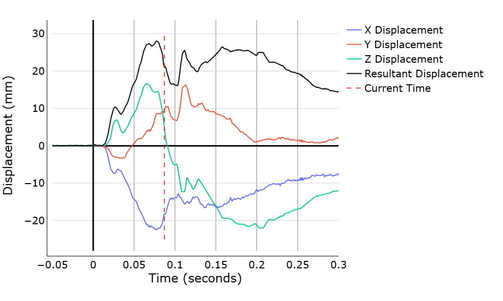 Chest Deflection Visualization